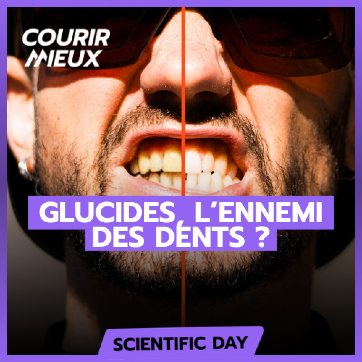 Trail et glucides, détruis-tu tes dents sans le savoir ?
